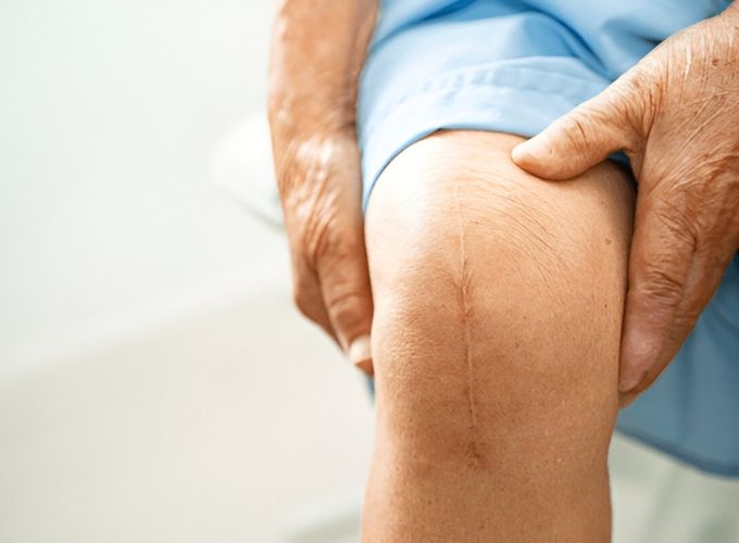 total-joint-replacement